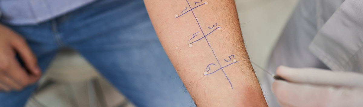 Какие анализы сдать при аллергии